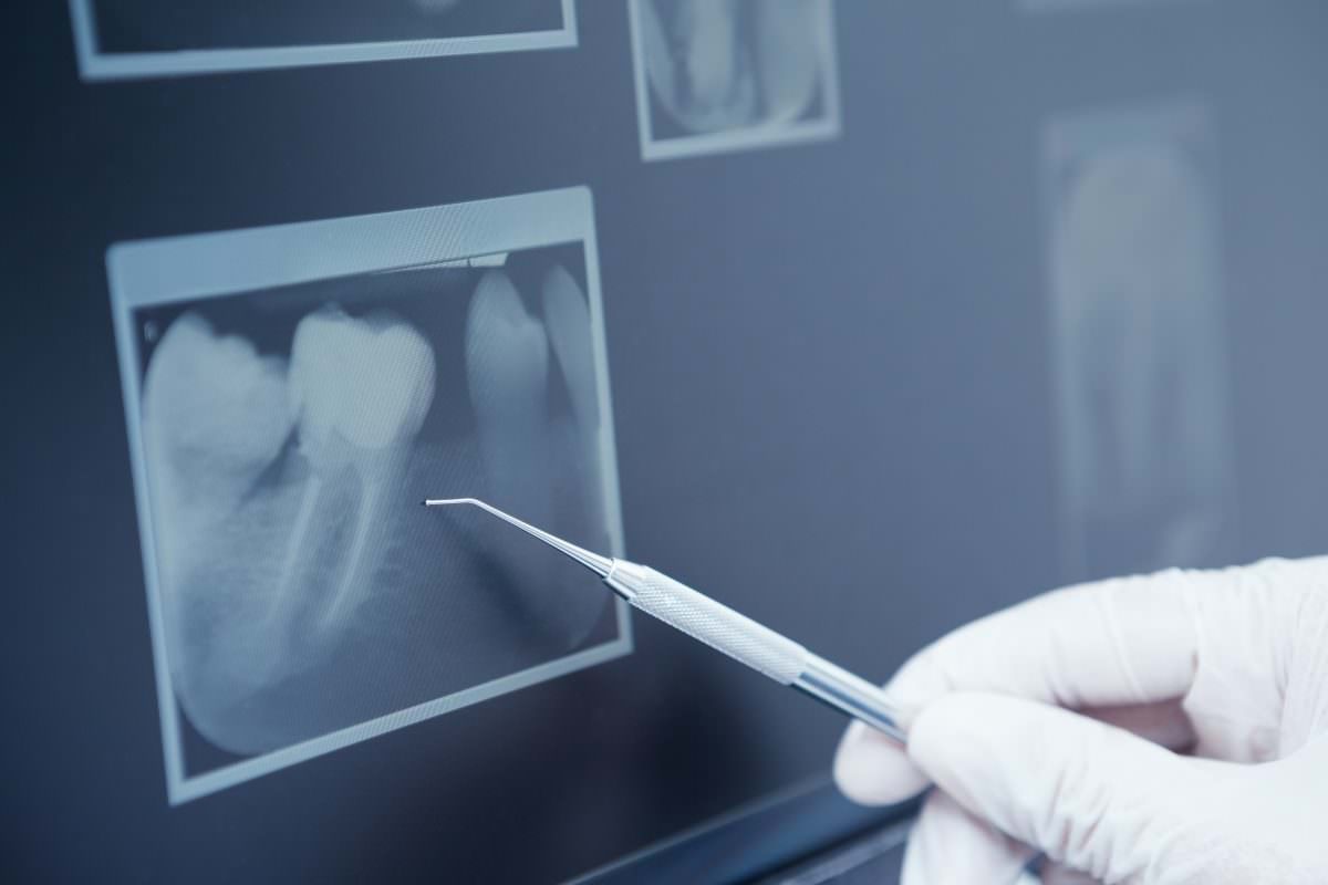 orthodontic evaluation