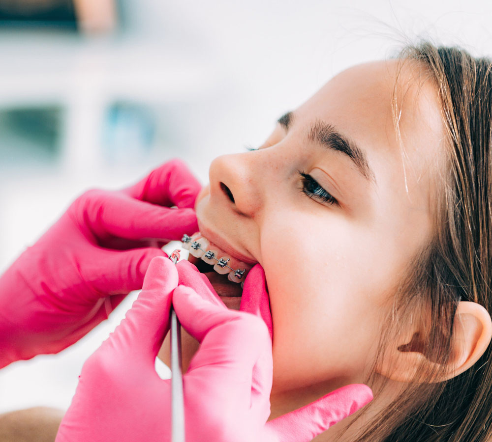 Children Braces | Dr Murray Orthodontics