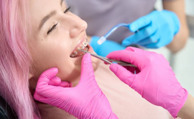 rubber bands correct an overbite