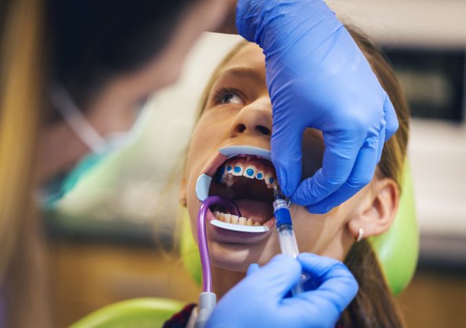 Child receiving early orthodontic care to correct crowded teeth and support jaw development